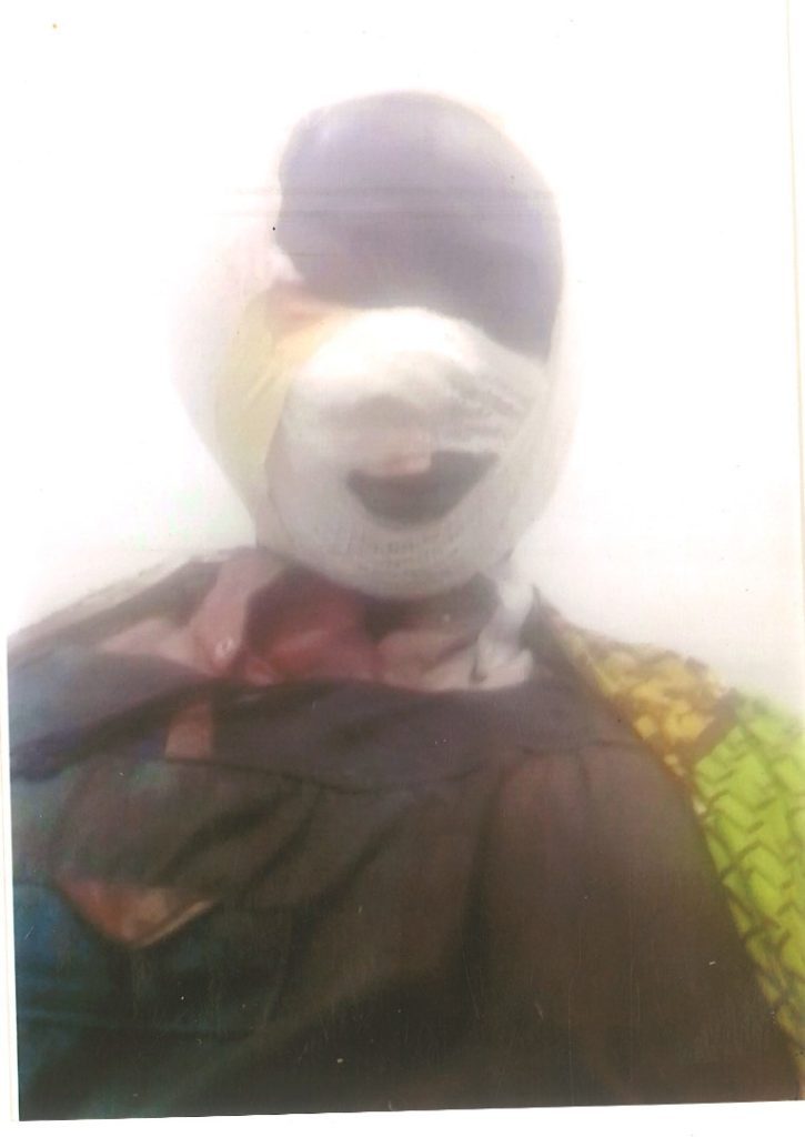 Injured worker drags Domod Aluminium to court 